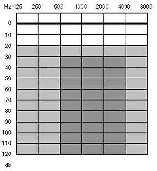 Audiogramme zones